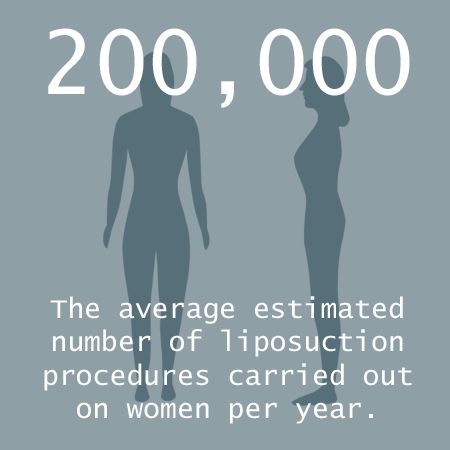 liposuctionukstats