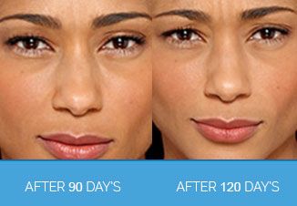 Wrinkle Smoothing4