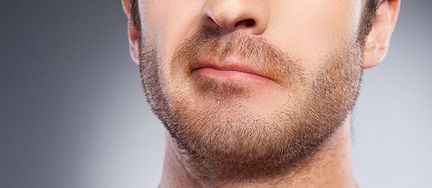 beard/Moustache transplant