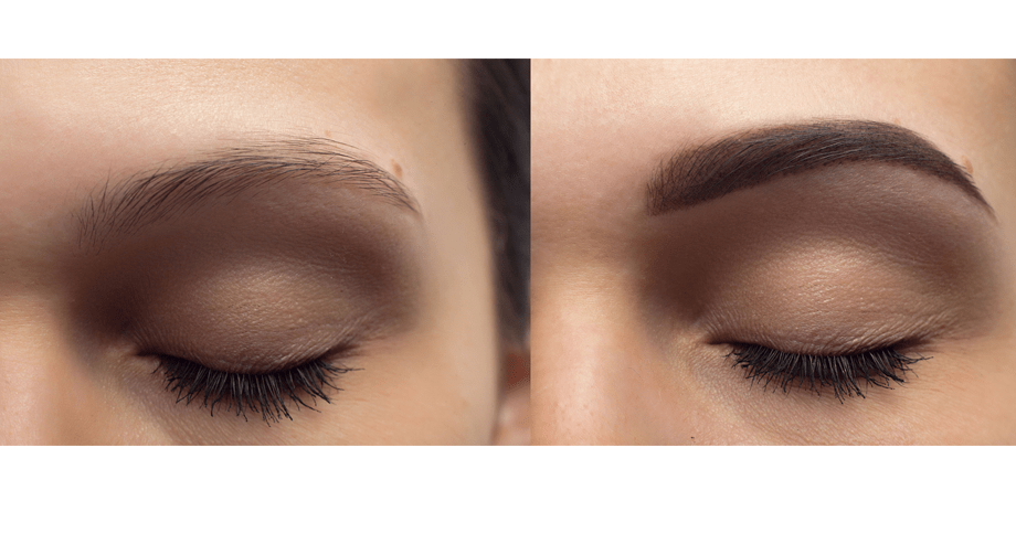 eyebrow restoration