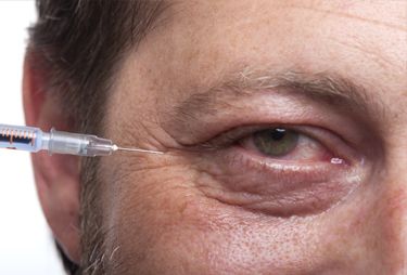 Brotox treatment