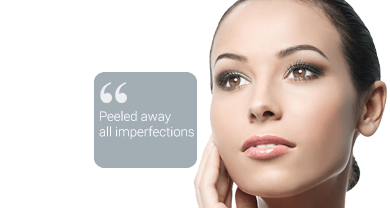 Chemical Peel