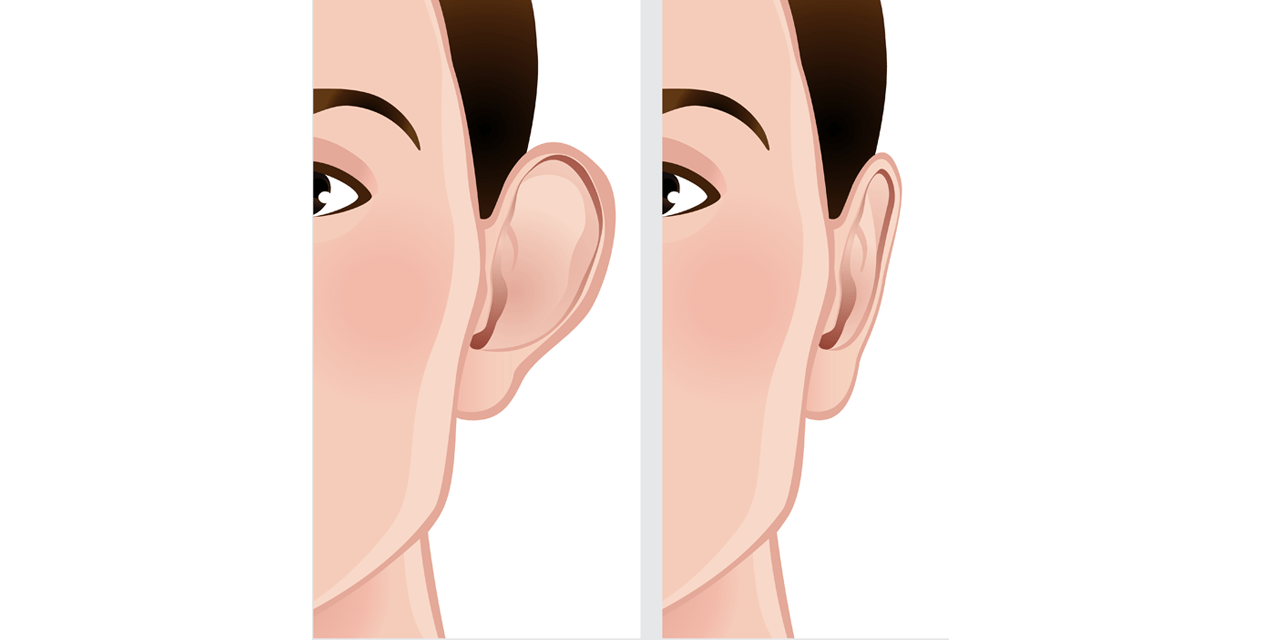 Eye Bag Removal Surgery before and after