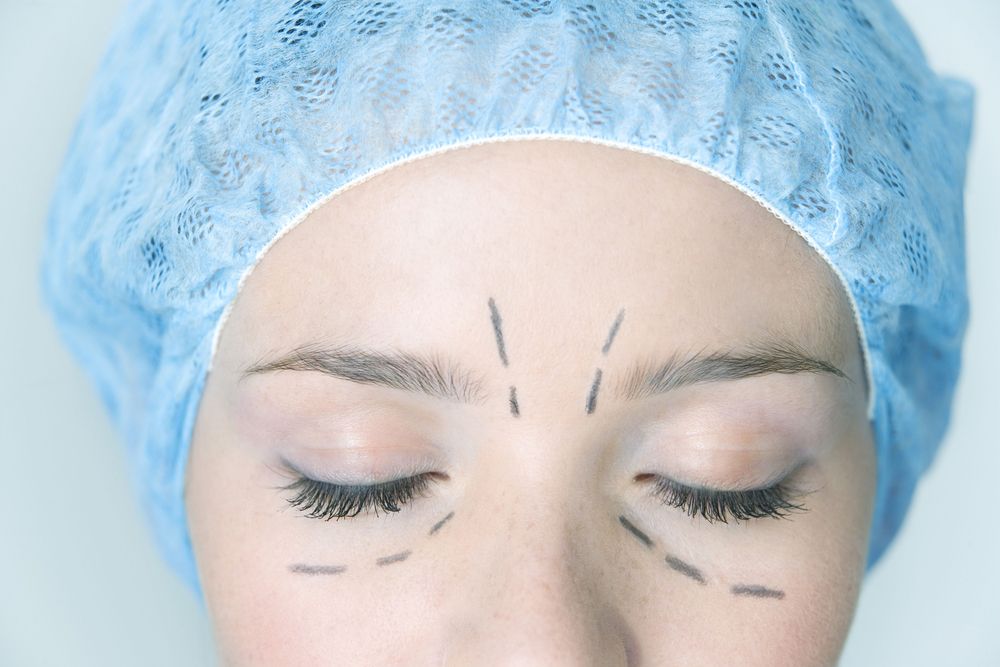 get_upper_and_lower_eyelid_surgery_blepharoplasty_and_look_younger