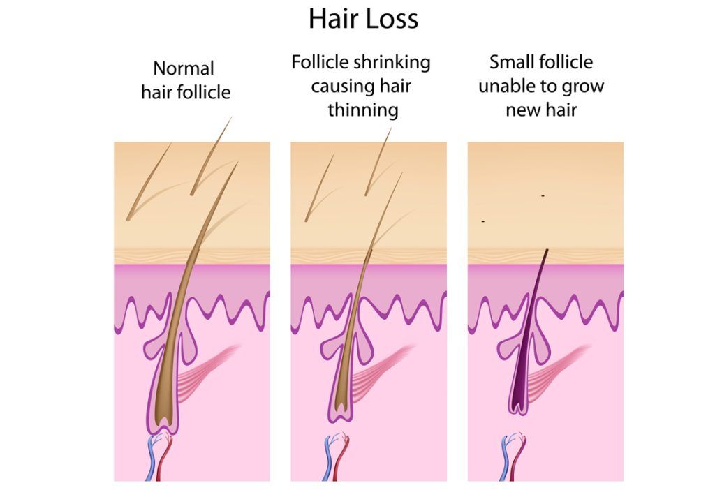 hair-transplant-procedure