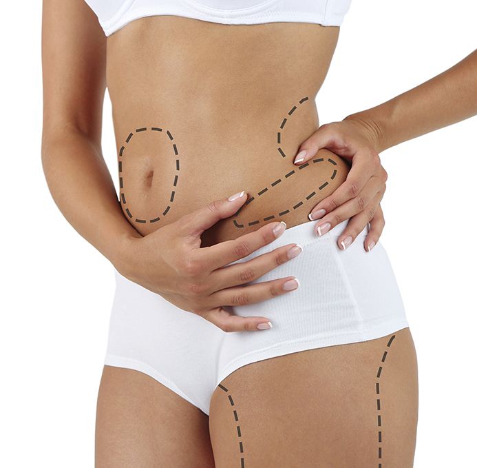 Treatment with Carboxytherapy