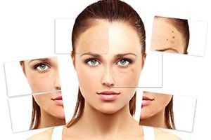 non-surgical-treatments
