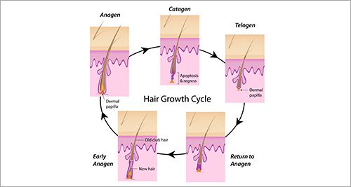 Hair Transplant