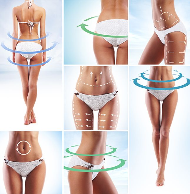 liposuction