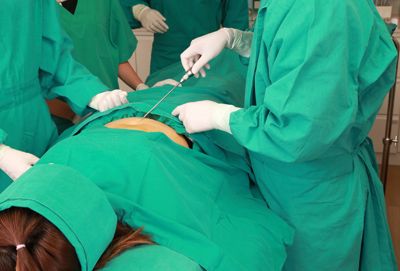 VASER Liposuction Strategy