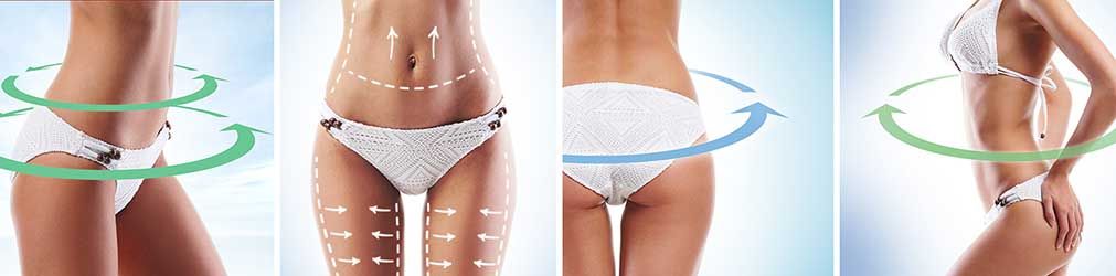 vaser liposuction