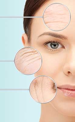 wrinkle smoothing