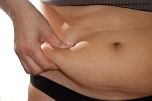 vaser lipo treatment