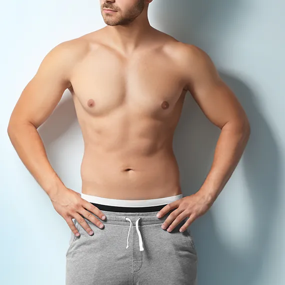 gynecomastia