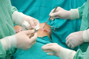Advances in Breast Enlargement Procedure