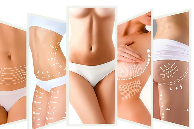 cosmetic surgery advantages