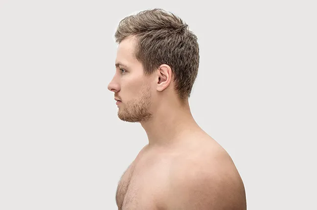 ear correction for men