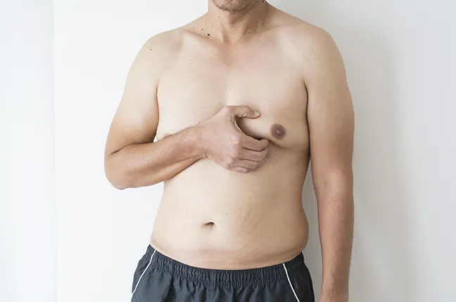 men breast reduction