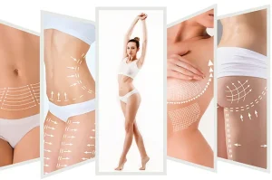 Psychological Aspects of Plastic Surgery