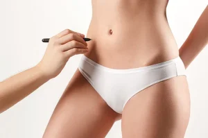 VASER Liposuction: The Easiest Way to Eliminate Stubborn Fat