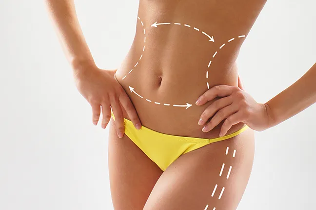 understanding liposuction procedure