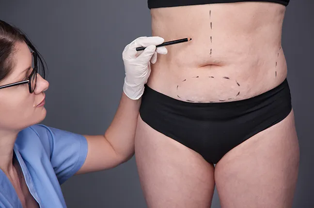 understanding liposuction