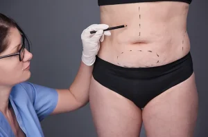 Answering the top questions asked from our surgeons about Vaser Liposuction