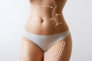 Professional Vaser Liposuction in Birmingham by Experts