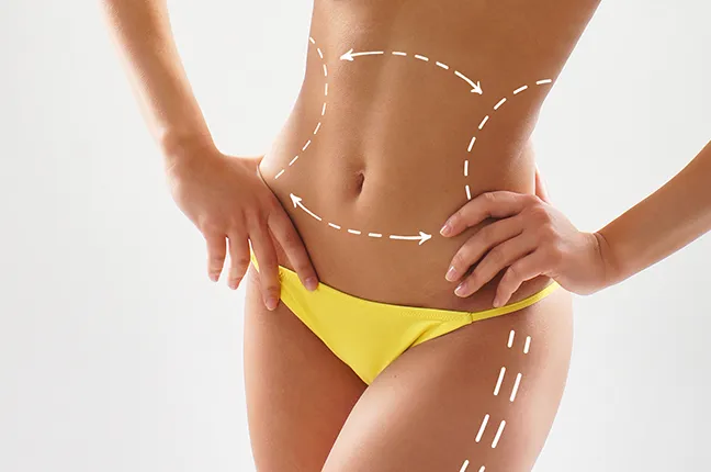 vaser liposuction treatment